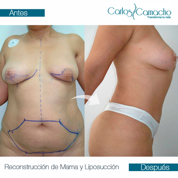 Slider image (5) Dr. Carlos Camacho and Dr. Claudia Camacho